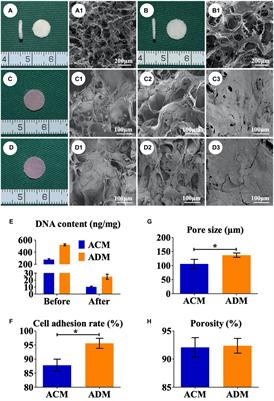 Biological Evaluation of Acellular Cartilaginous and Dermal Matrixes as Tissue Engineering Scaffolds for Cartilage Regeneration
